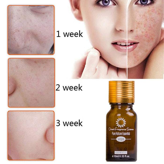 Dragare Meridian Skin Care Rimozione pura naturale Acne Smagliature Rimozione cicatrici Olio essenziale