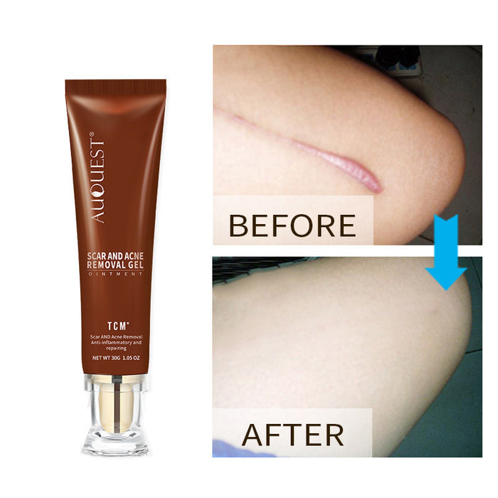 Moisturizing and repairing scar skin care cream